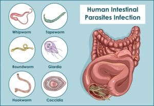 Human Intestinal Parasites - get help at Natural Medicine & Detox