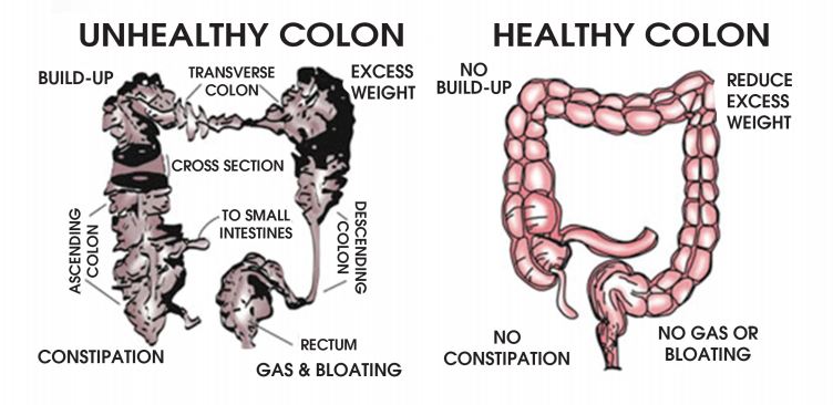 Colon Hydrotherapy Cleanse at Natural Medicine and Detox