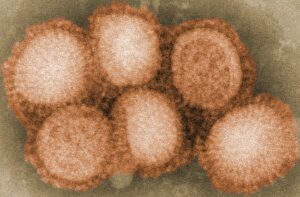 Influenza (flu) virus